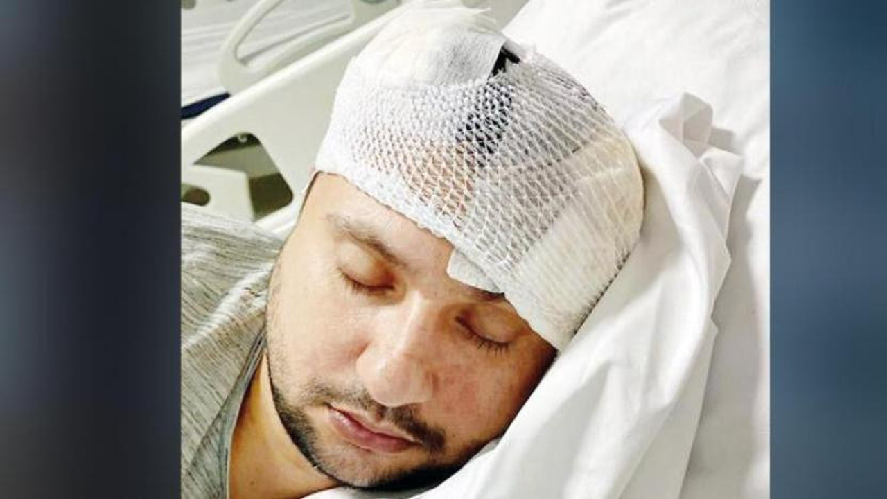 6 taksici pala ve sopalarla müşteriyi dövdü, öldü sanıp bıraktılar. Talihsiz adamın beyninde ödem oluştu