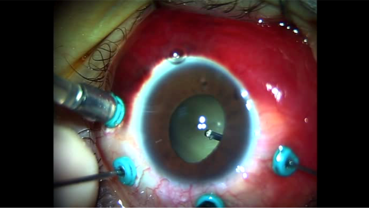 Ölümü yenme ihtimali var (mı)? (13 Mayıs 2022)