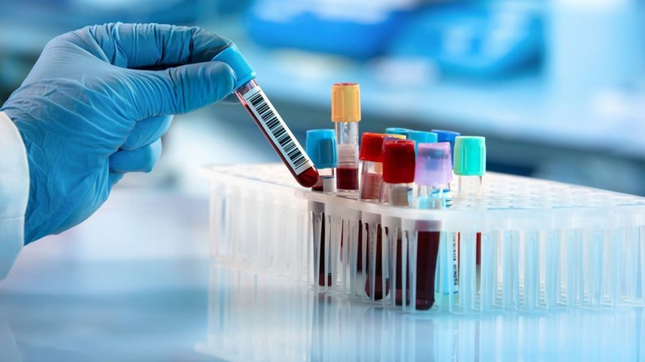 İngiltere'de maymun çiçeği vaka bilançosu artıyor