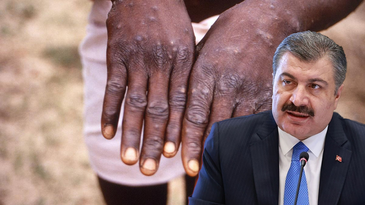 Bakan Koca'dan yeni maymun çiçeği virüsü açıklaması