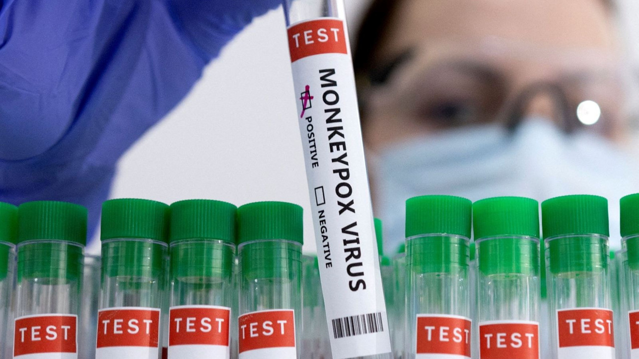 Arjantin'de ilk maymun çiçeği vakası görüldü