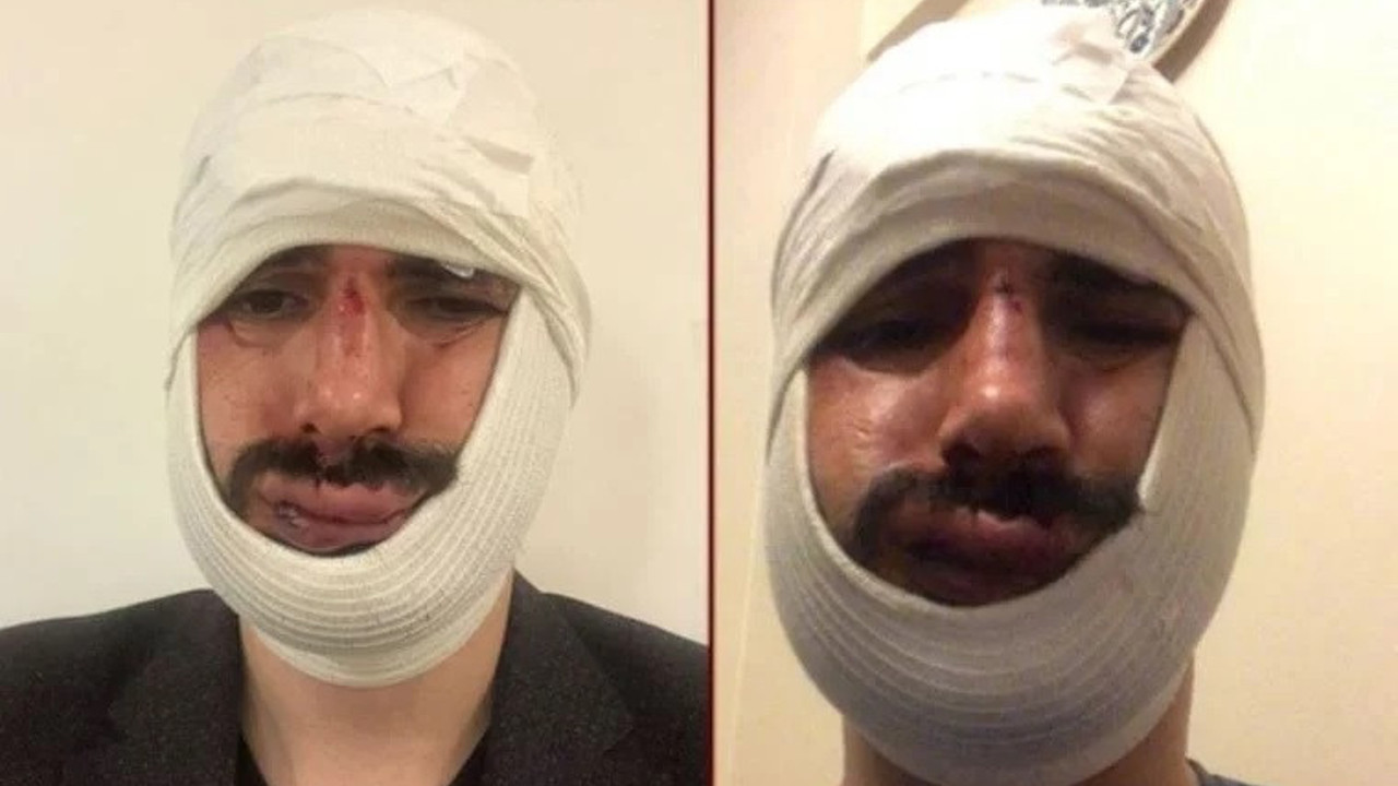 Anadolu Ajansı muhabirine saldıran iki sanığa hapis cezası