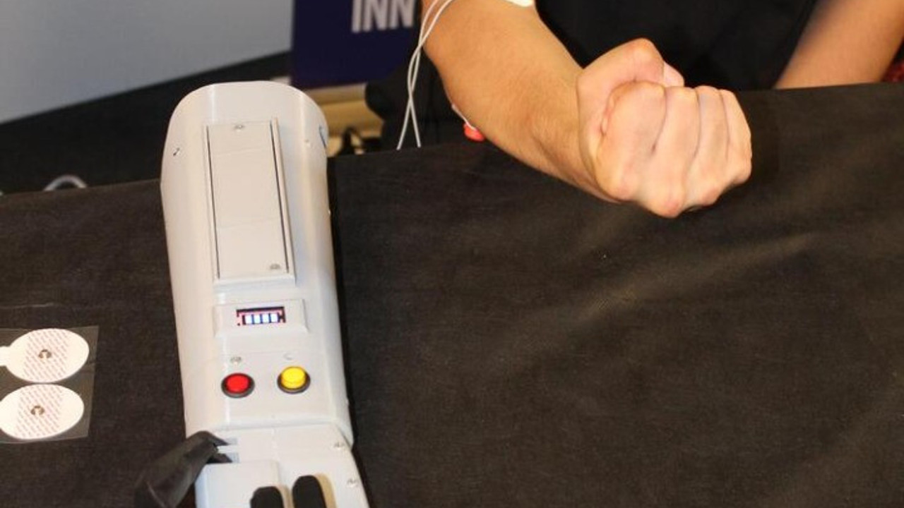 Metrodaki tek kollu kızdan etkilendiler. Kasla çalışan biyonik kol yaptılar