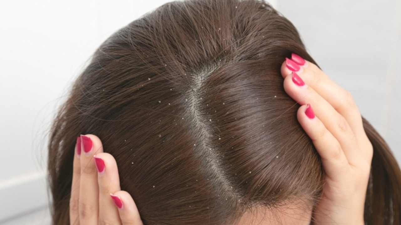 Saç tasarımcısı Zili: Kepekten kurtulmak kolay