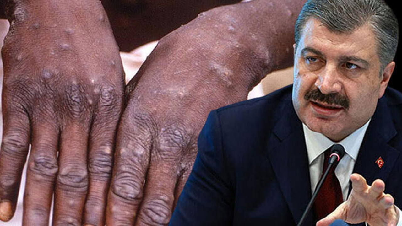 Bakan Koca’dan Maymun çiçeği virüsü açıklaması