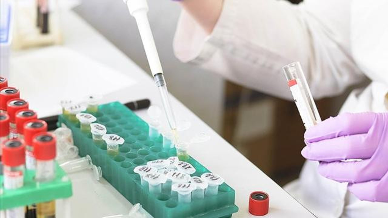 Singapur'da da maymun çiçeği vakası görüldü