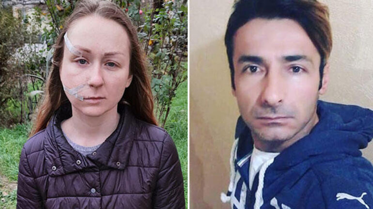 11 yıl hapis cezası istinaftan döndü! Ukraynalı eşinin yüzünü falçatayla kesmişti…