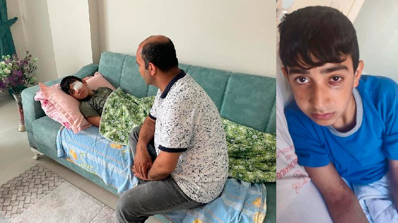 Ortaokulda görme kaybı yaşatan dayak. Sınava göz bandıyla girdi