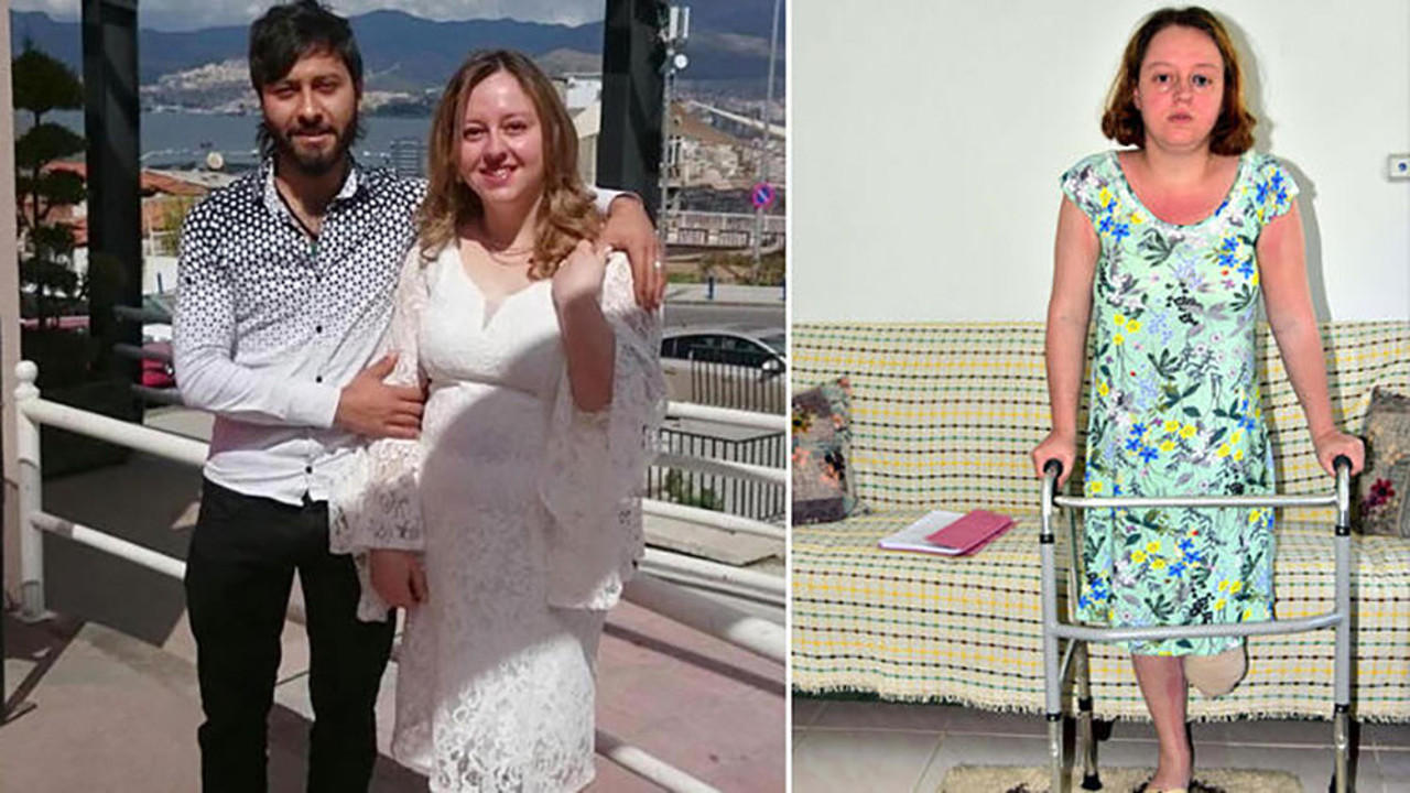 Eşini vurup bacağının kesilmesine neden olan kocanın cezası belli oldu