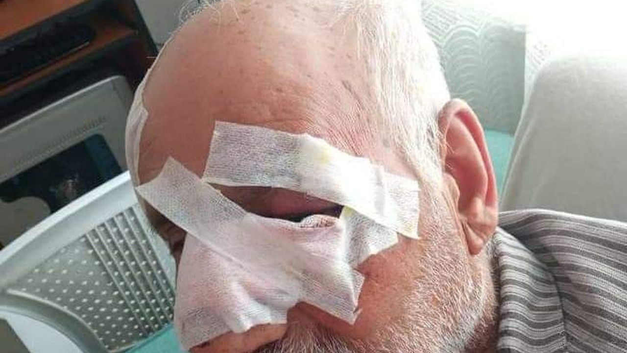 Kimse dur demeyince korkulan oldu. Sokak köpeğinin saldırısına uğrayan yaşlı adam öldü