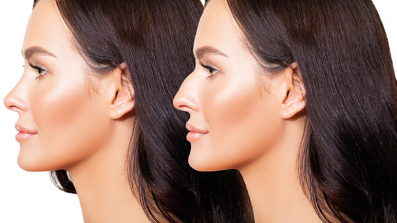 Yaz mevsiminde burun estetiği yaptırmak isteyenlere uzmanından uyarı