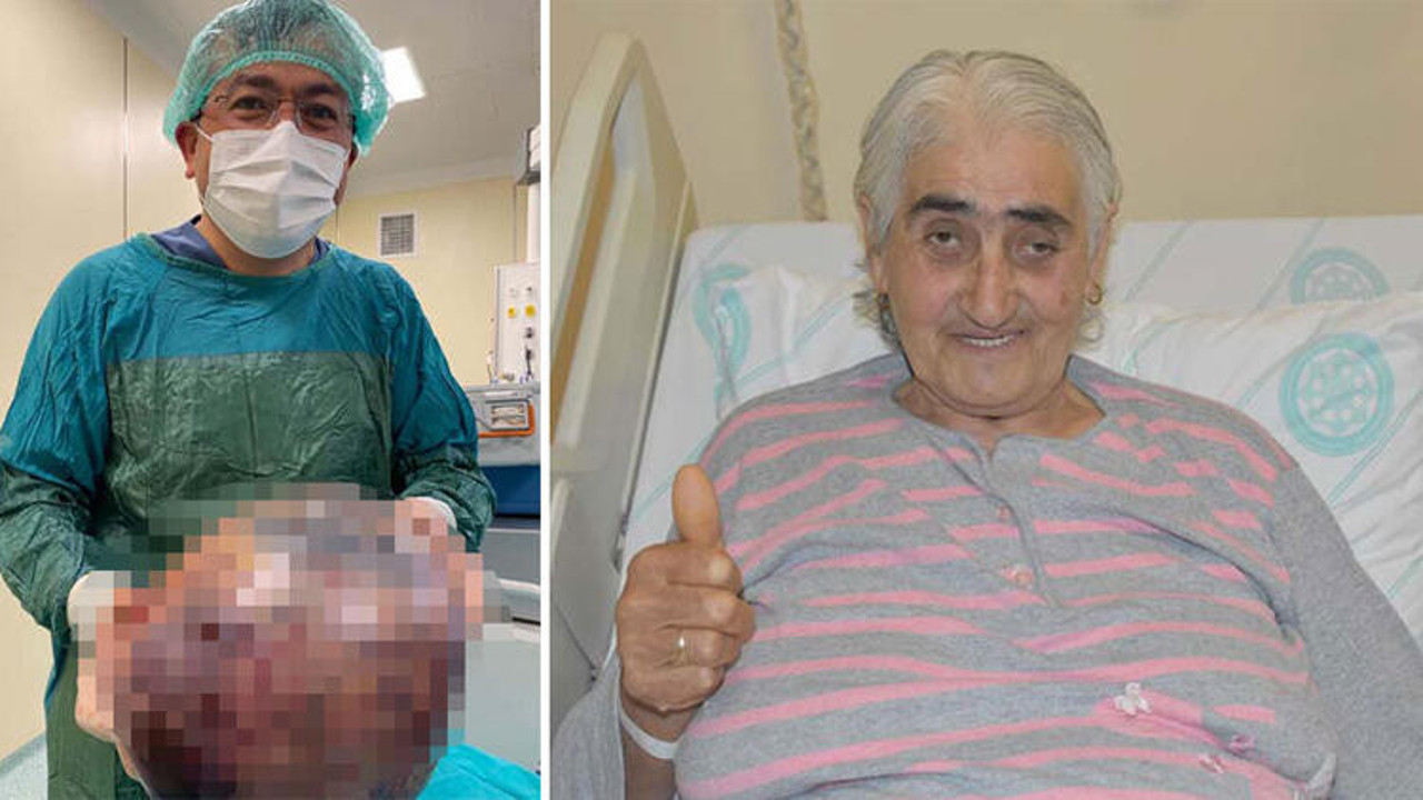 Nefes darlığı şikâyetiyle gitti. Karnından 10 kilo tümör çıkarıldı