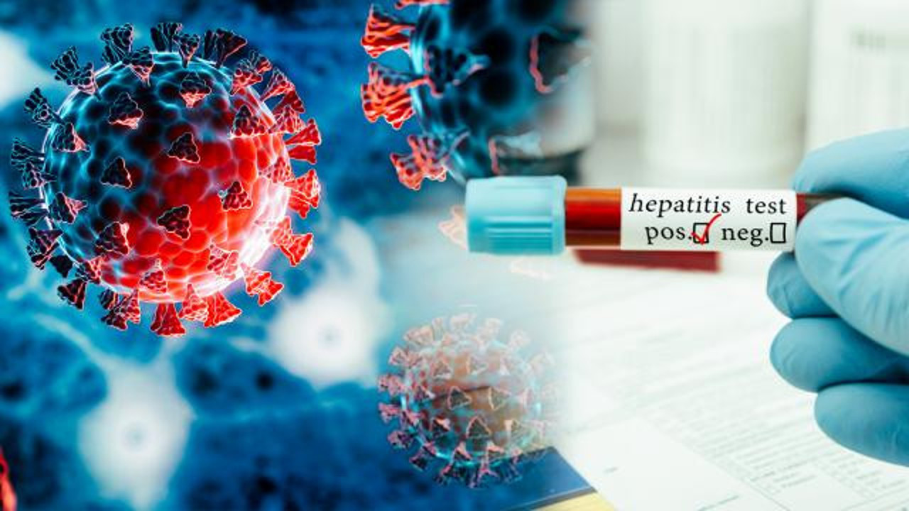 Bir bela daha yayılıyor! Gizemli hepatit vaka sayısı 1000'i geçti