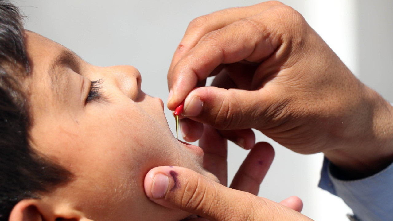 ABD’de 2013’ten bu yana ilk çocuk felci vakası