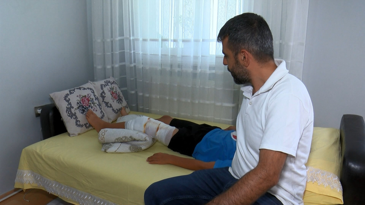 Bahçelievler’de Pitbull dehşeti. Oyun oynayan çocuğa saldırdı. Ağzından zor kurtardılar