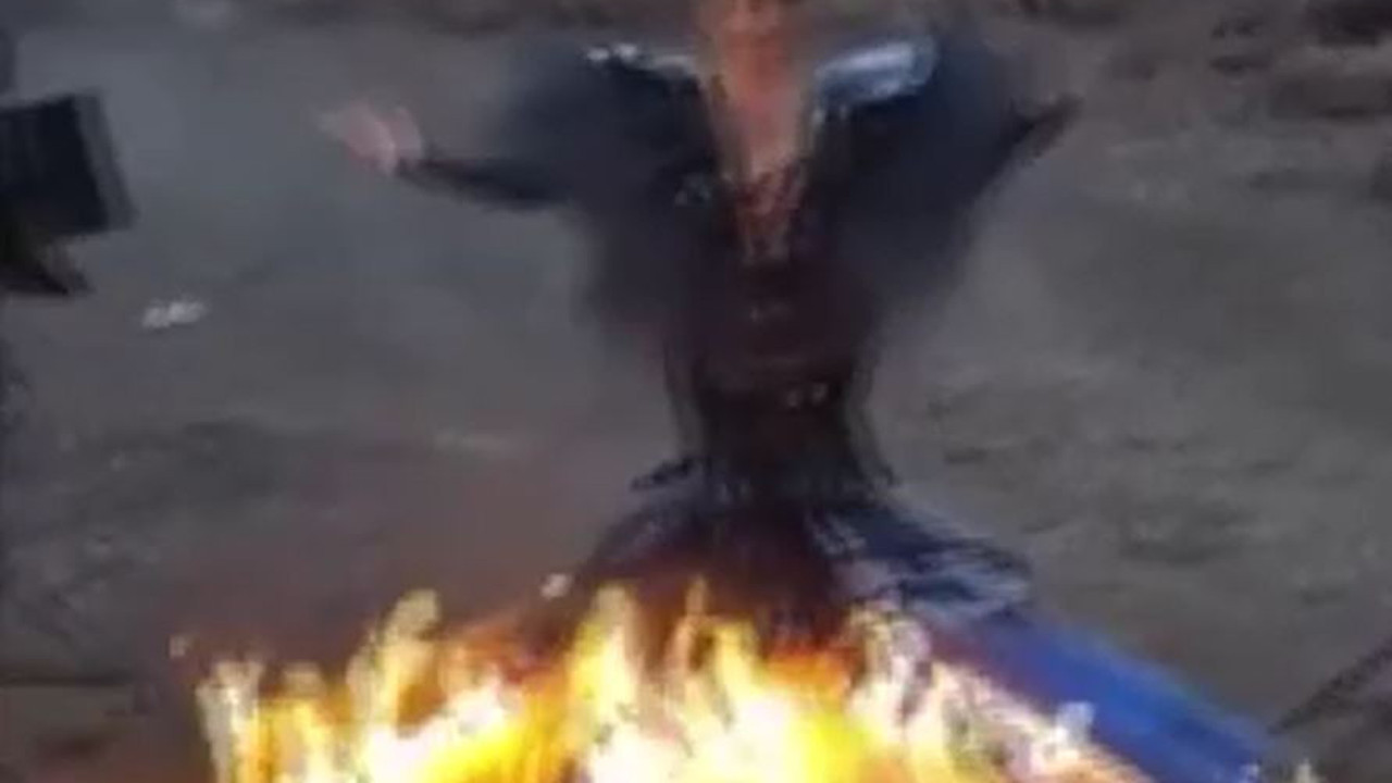 Mankenin zor anları. Elbise tutuştu ölümden döndü