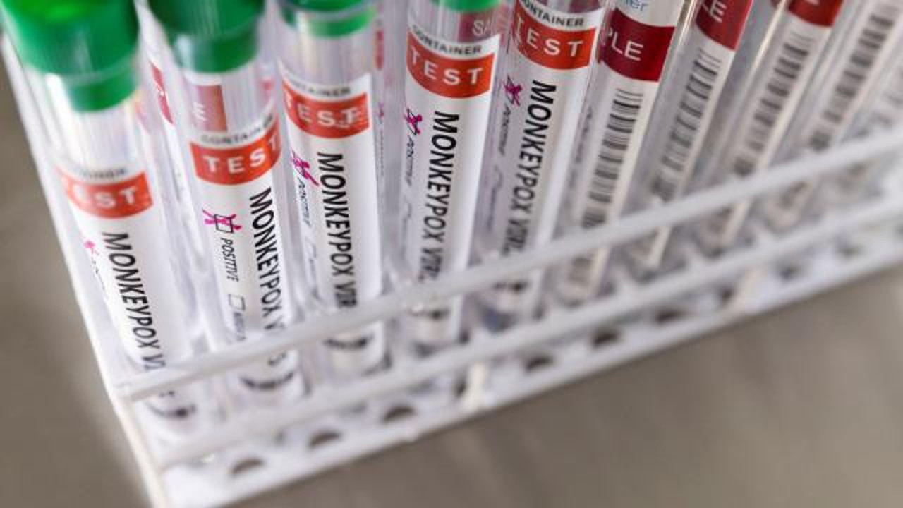 Liberya'da ilk maymun çiçeği vakası görüldü