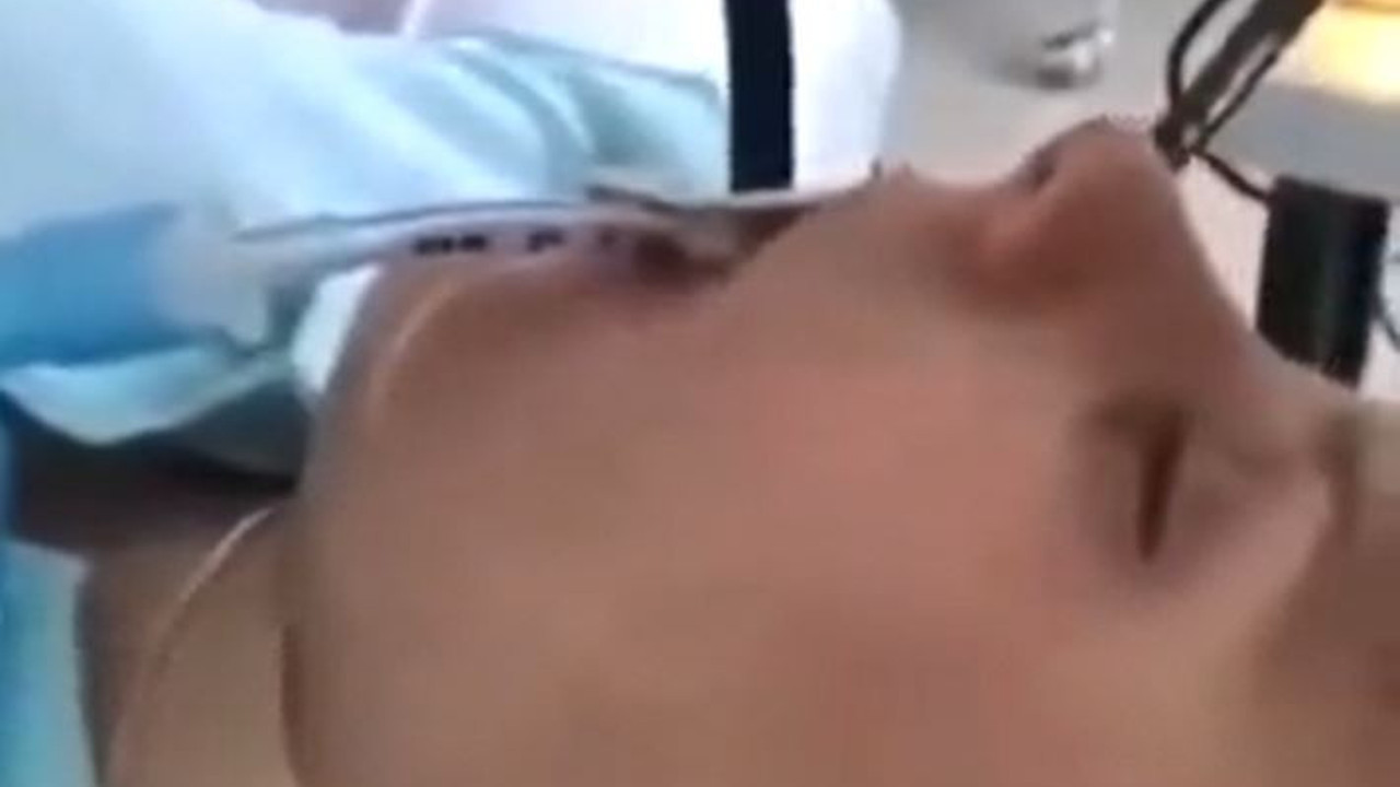 Endoskopiye alınan hastanın midesinden 1,5 metrelik canlı çıktı