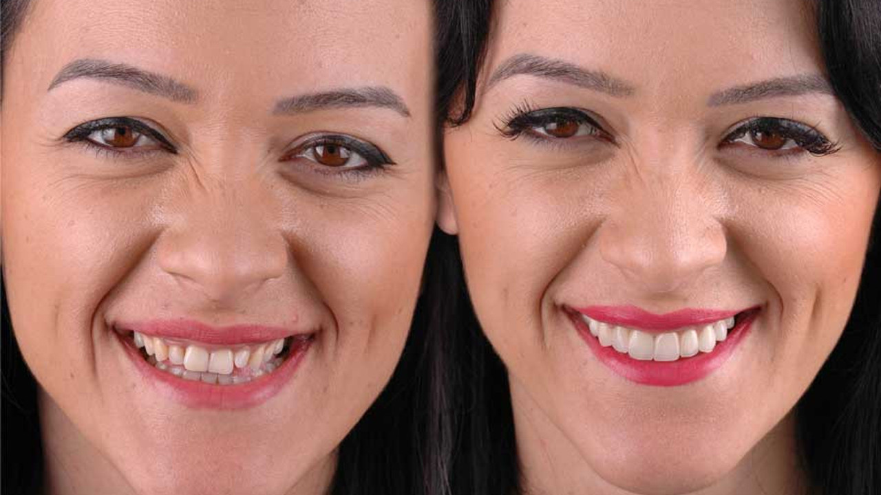 Diş hekimi özgüvenin sırrını açıkladı