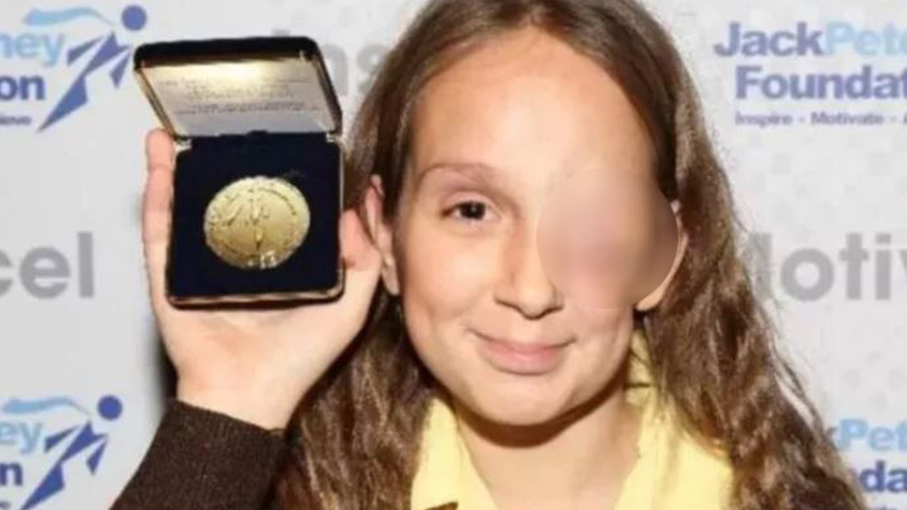 Nadir görülen hastalığa yakalandı. Önce gözünden sonra canından oldu