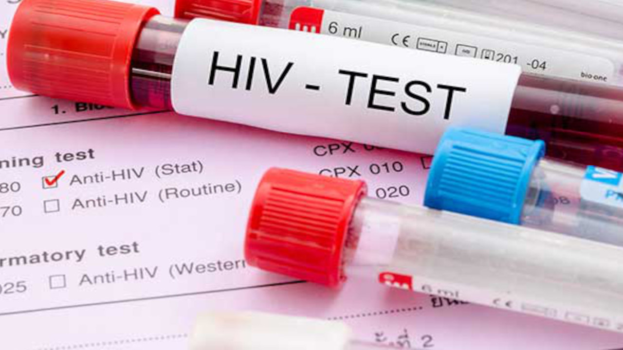 HIV enfeksiyonuyla ilgili uzmanından sevindiren haber