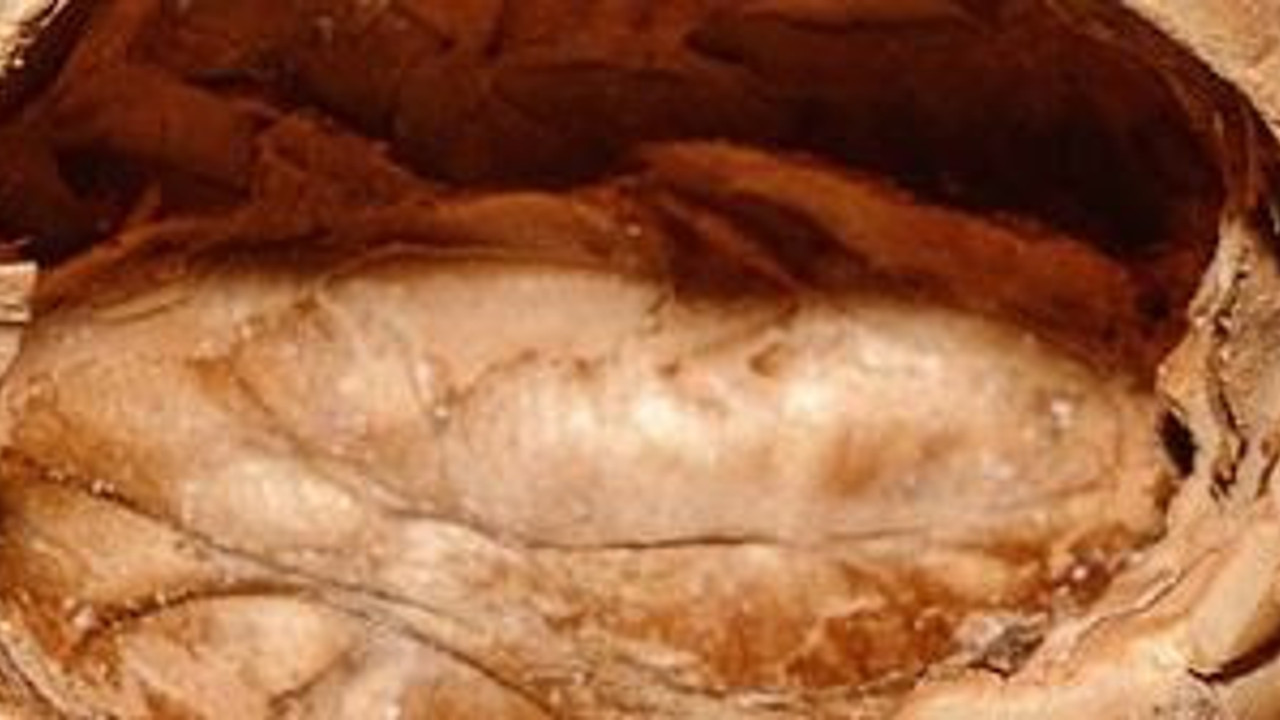 Bu meyvenin kabuğu saç dökülmesini anında durduruyor