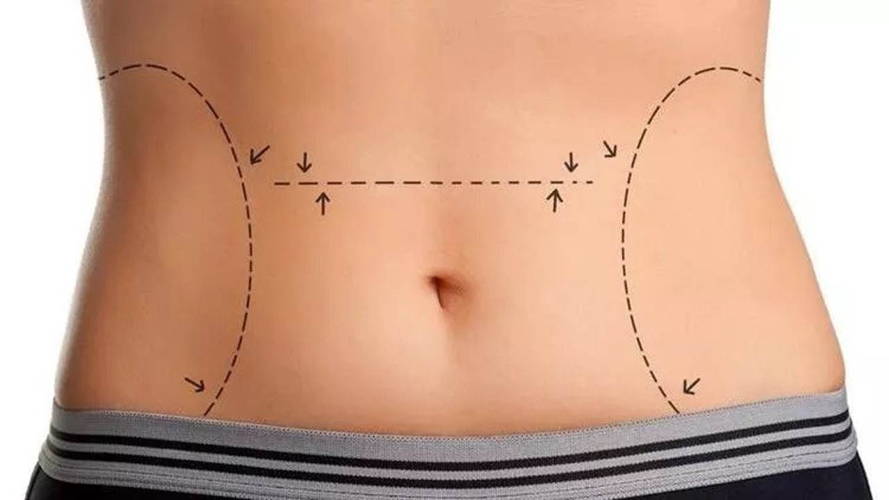 Doğum sonrası estetiği ne zaman ve nasıl olmalı? (21 Aralık 2022)