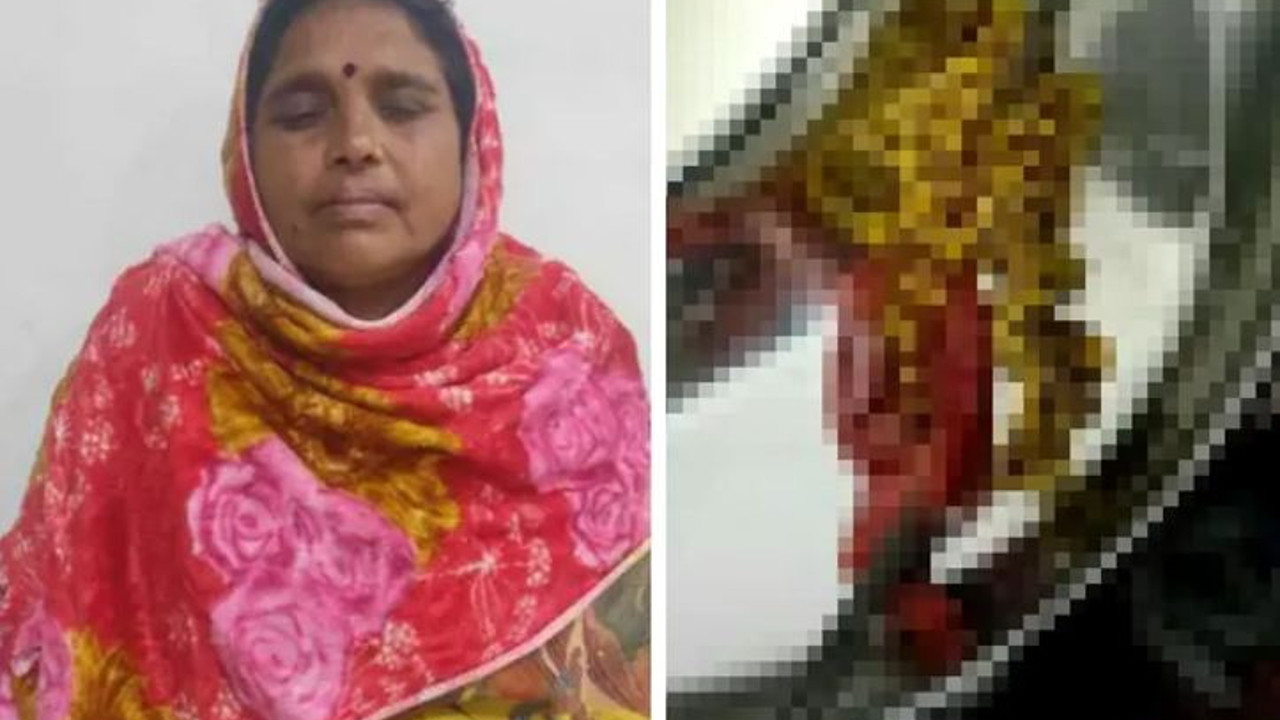 Tam 382 tane çıkarıldı. Doktorlar gözlerine inanamadı