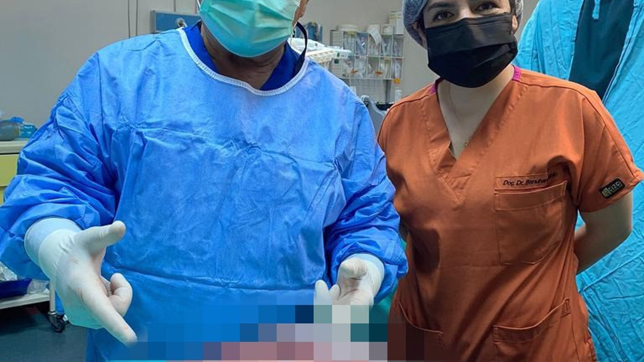Karnından 7,5 kilo kitle çıktı. Doktor şok oldu