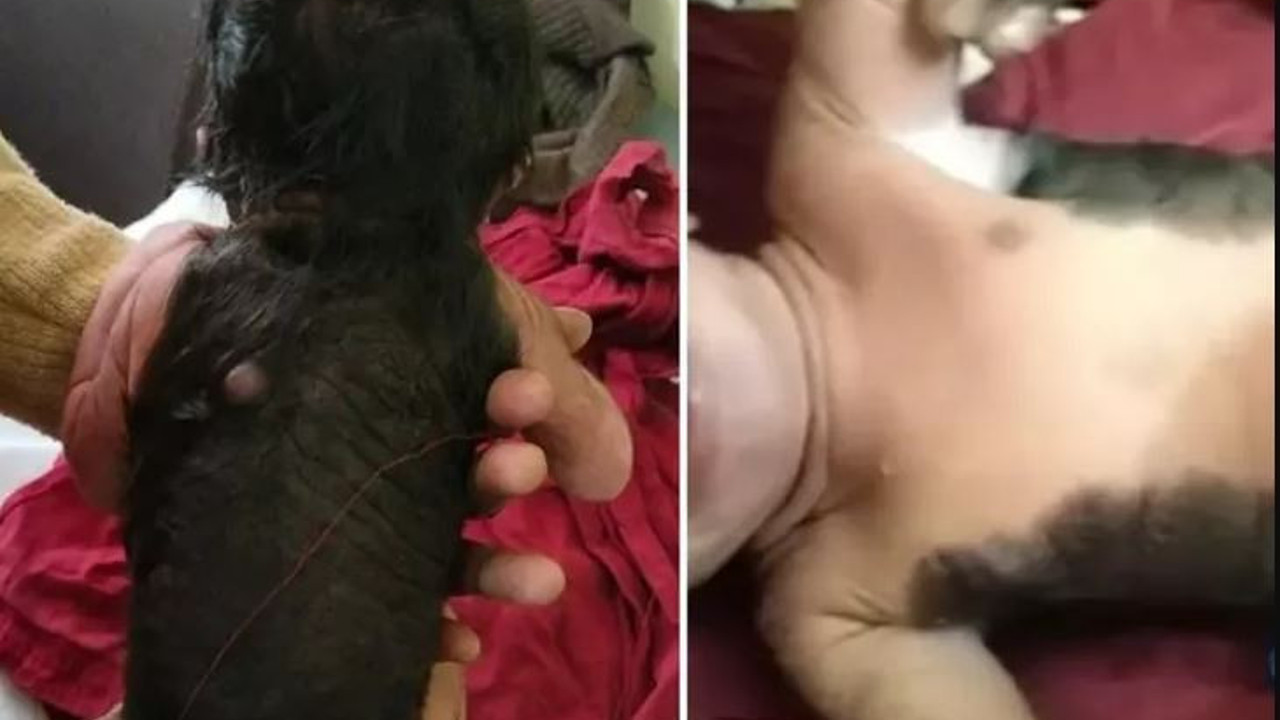 Yenidoğan bebek 'kurt adam' olarak doğdu. Doktorları bile hayrete düşürdü