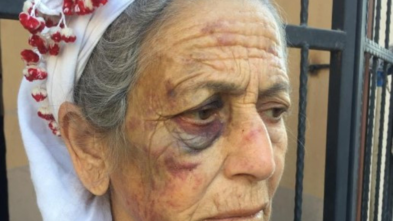 Kanser hastası yaşlı kadını dakikalarca dövüp gasp etti