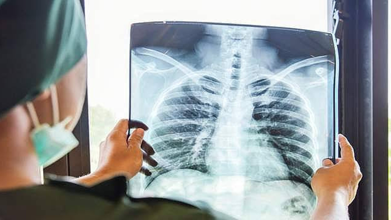 Tedavisi mümkün o hastalıktan 1,6 milyon kişi hayatını kaybetti