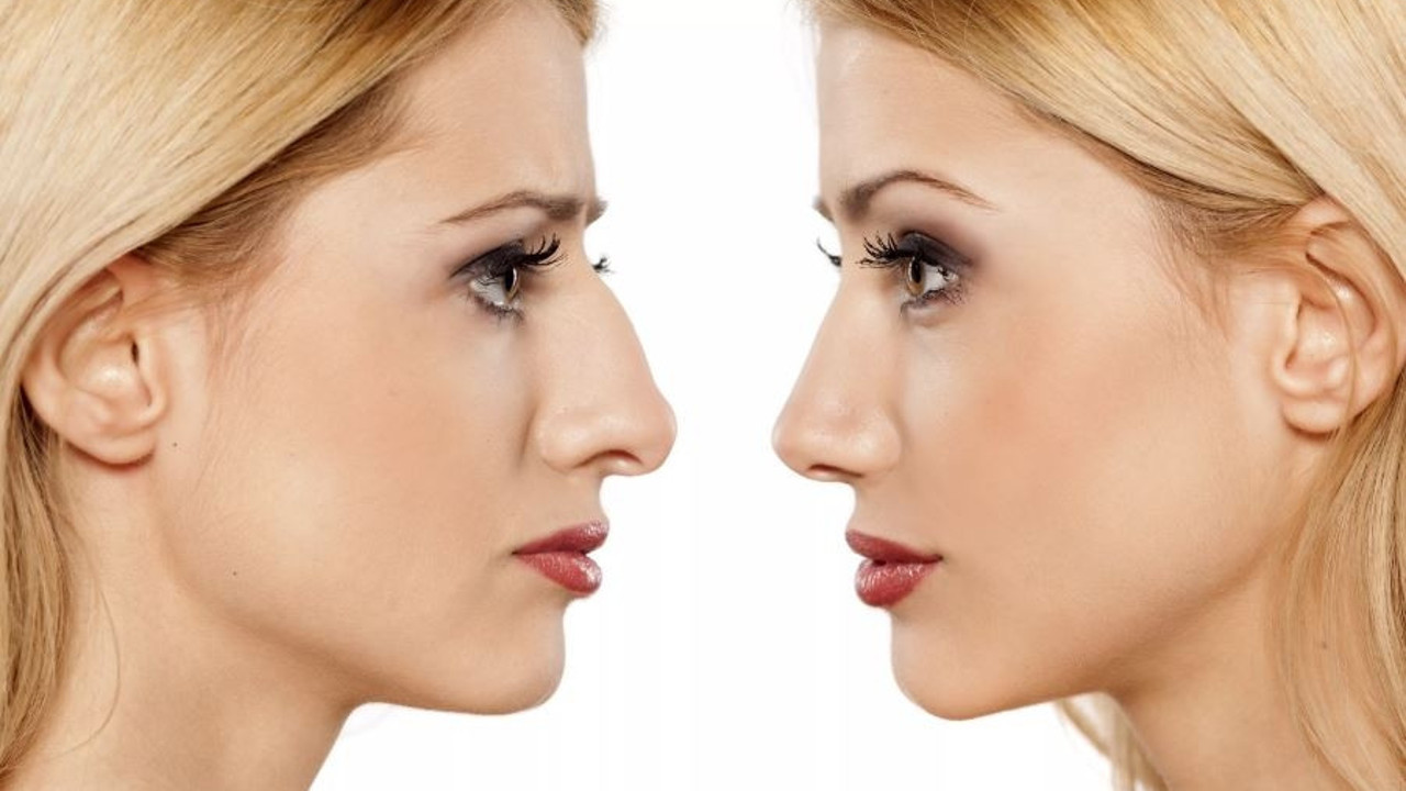 Güzellik isterken sağlığınızdan olmayın. Burun estetiği hakkında bilinmesi gerekenler
