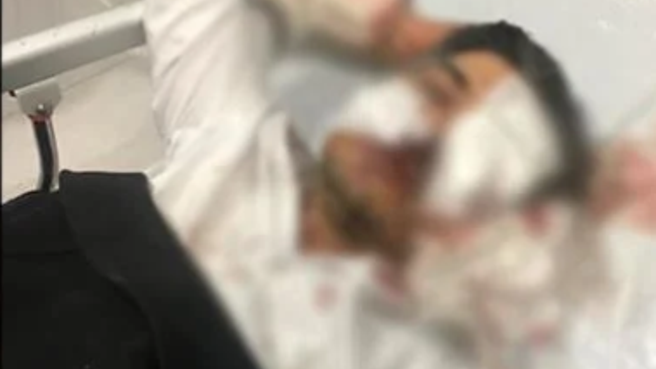 Sivas Ziraat Odası Genel Sekreteri saldırıda ağır yaralandı