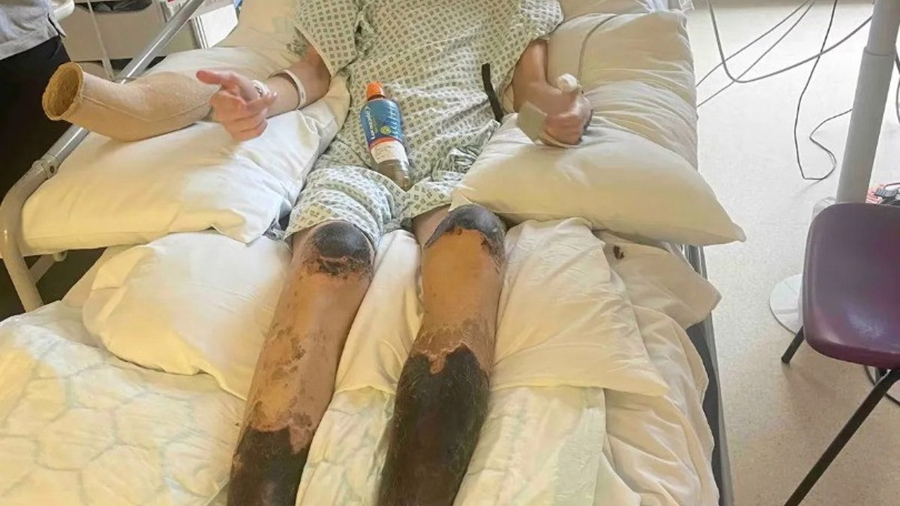 Grip belirtisiyle hastaneye gitti. Genç futbolcunun bacakları kesildi