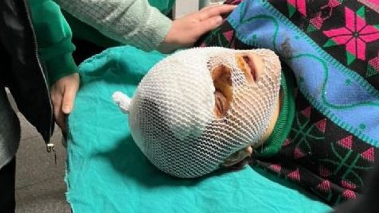 Barışmayan dini nikahlı karısına dehşeti yaşattı