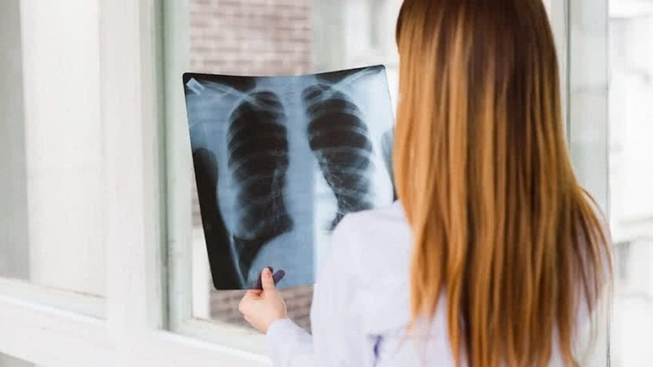 Erkeklerde ve kadınlarda en çok görülen kanser türleri belli oldu