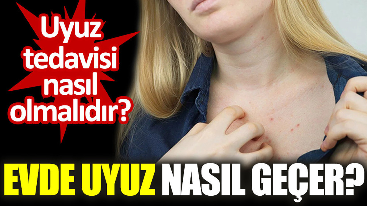 Uyuz tedavisi nasıl olmalıdır? Evde uyuz nasıl geçer?