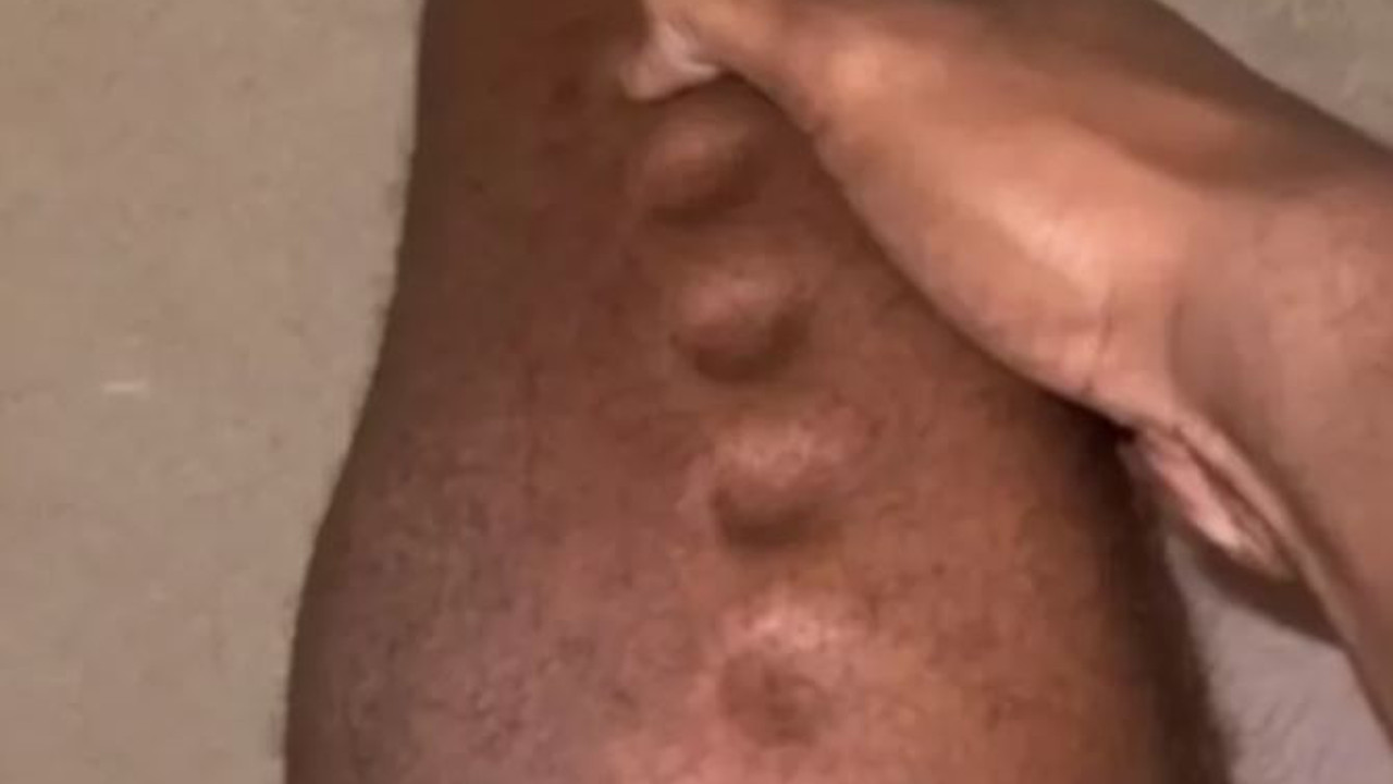 Sessiz katilin önemli belirtisi adam oyun hamuruna döndü