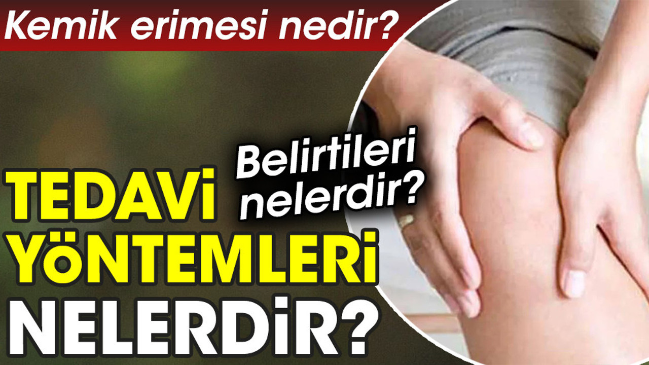 Kemik erimesi nedir? Kemik erimesi belirtileri nelerdir? Kemik erimesi tedavi yöntemleri nelerdir?