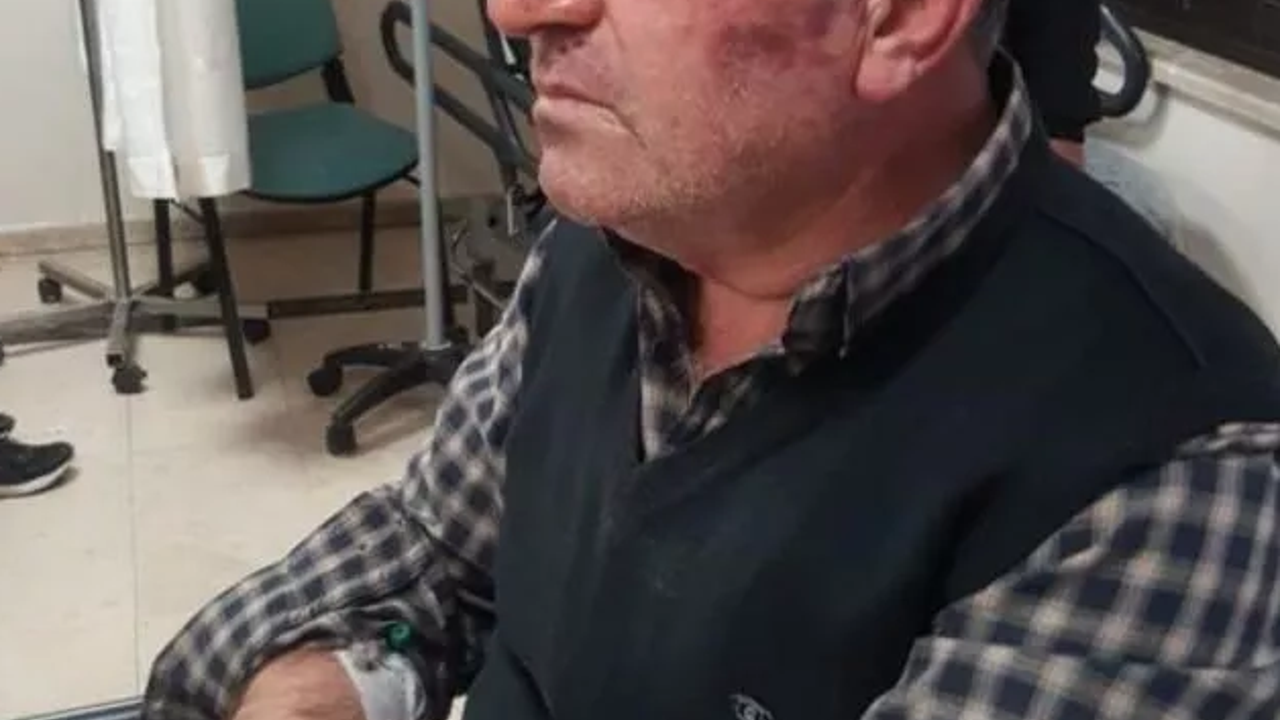 Böyle yanlışlık sadece Türkiye'de olur. Kulak zarını patlatıp ‘bu değilmiş’ deyip gittiler