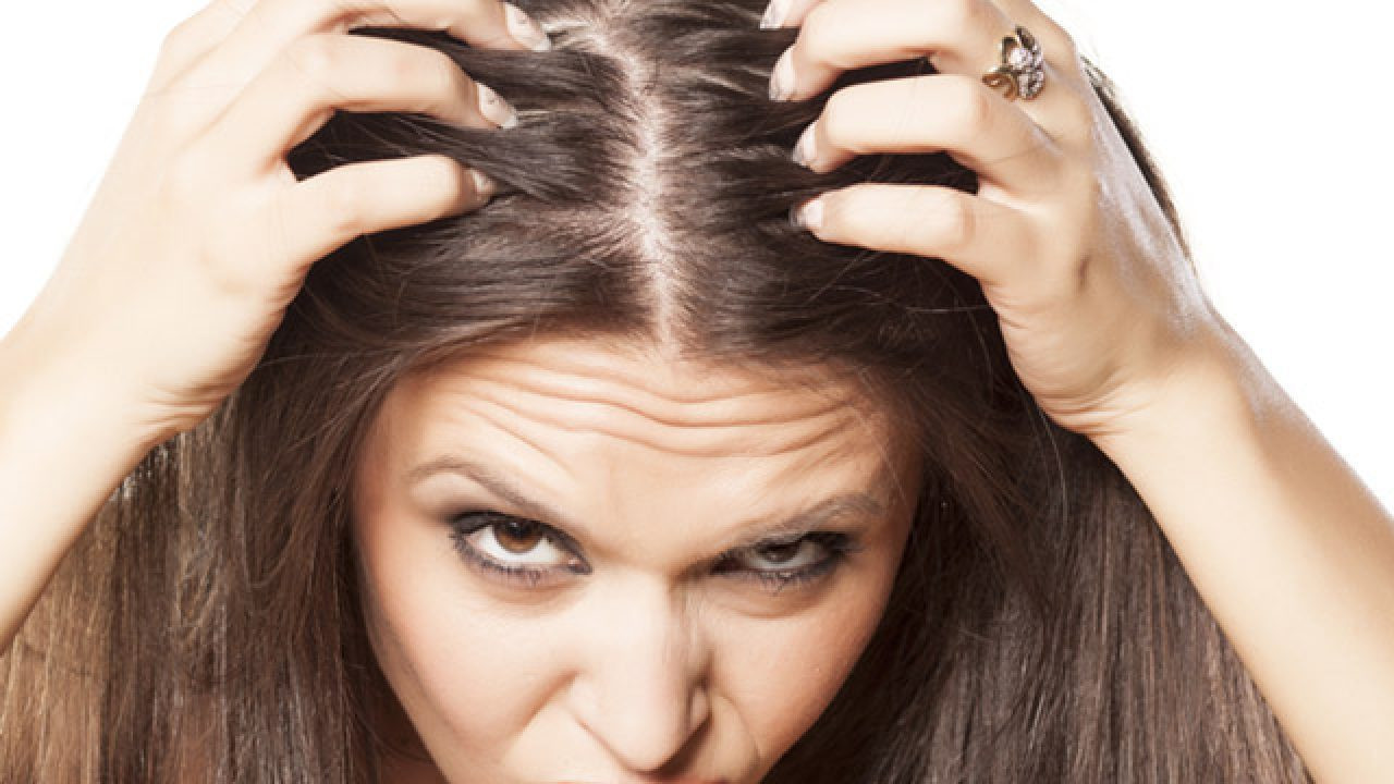 Saçkıran tedavi yöntemleri nelerdir?