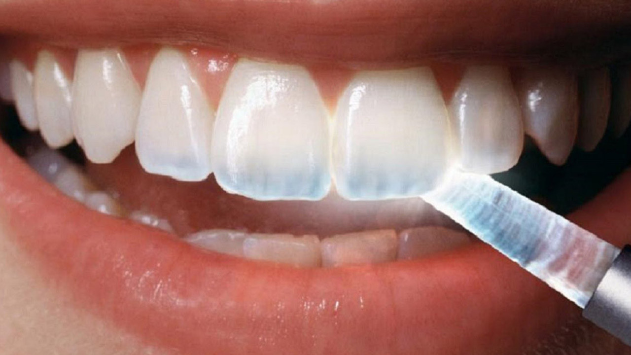 Dişlerinizin aşınması neyin habercisi