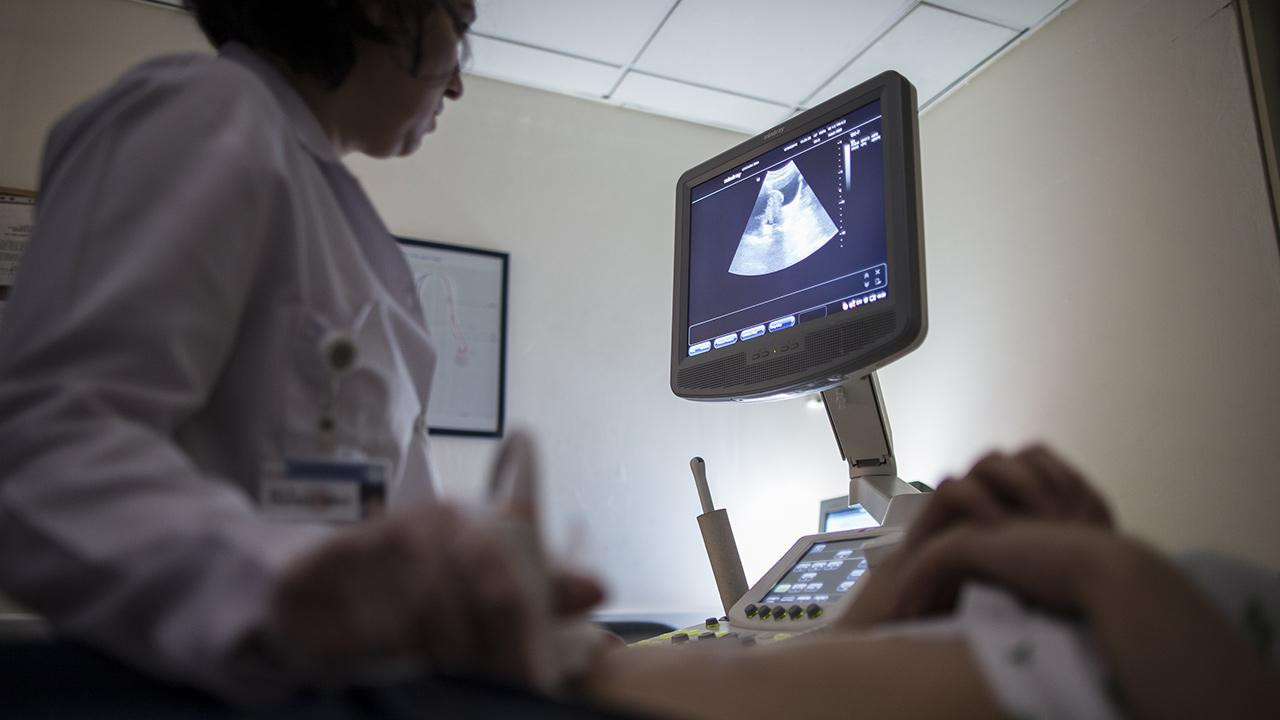 Hızla kilo alan hastadan 42 kilogram tümör çıkarıldı