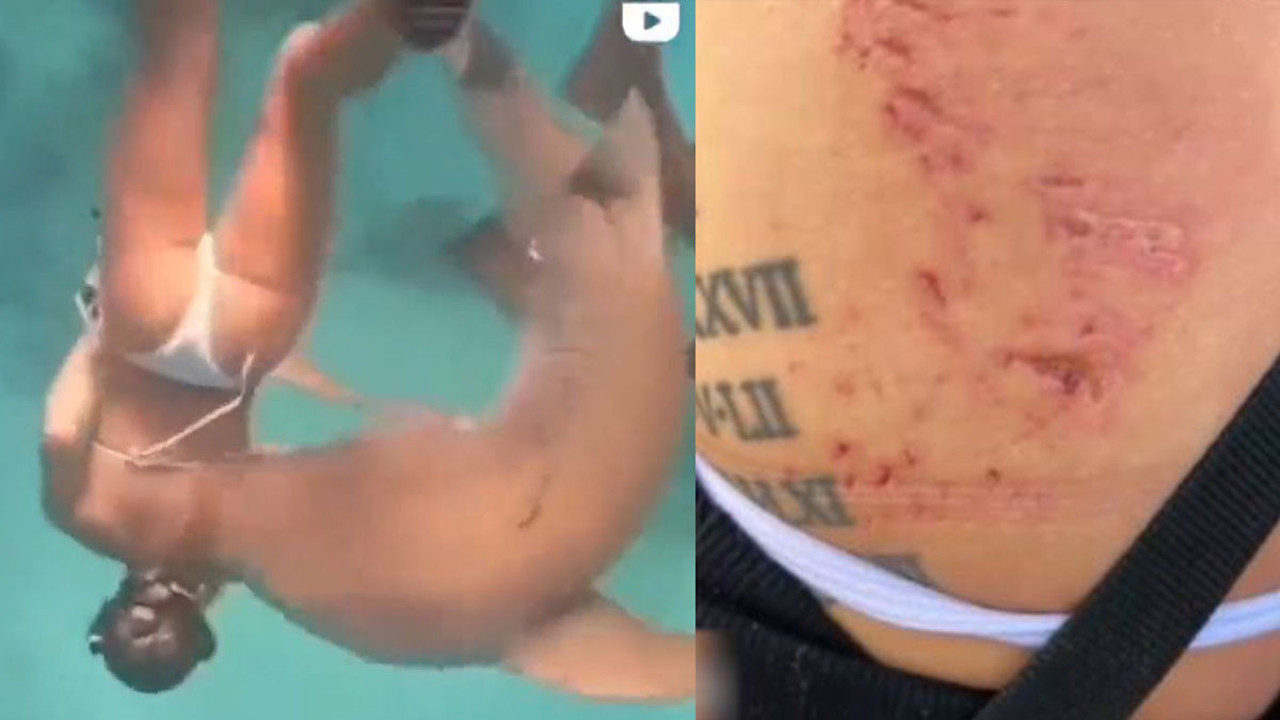 Köpek balığı genç kadını yakaladığı gibi ısırdı. Korku dolu anlar kameralara yansıdı