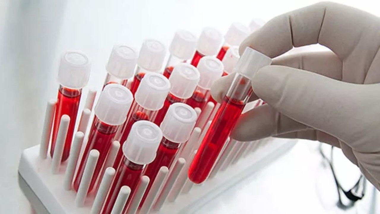 Hangi kan gruplarında olanlar daha uzun yaşıyor. Kan gruplarıyla ilgili bomba bilgi ortaya çıktı
