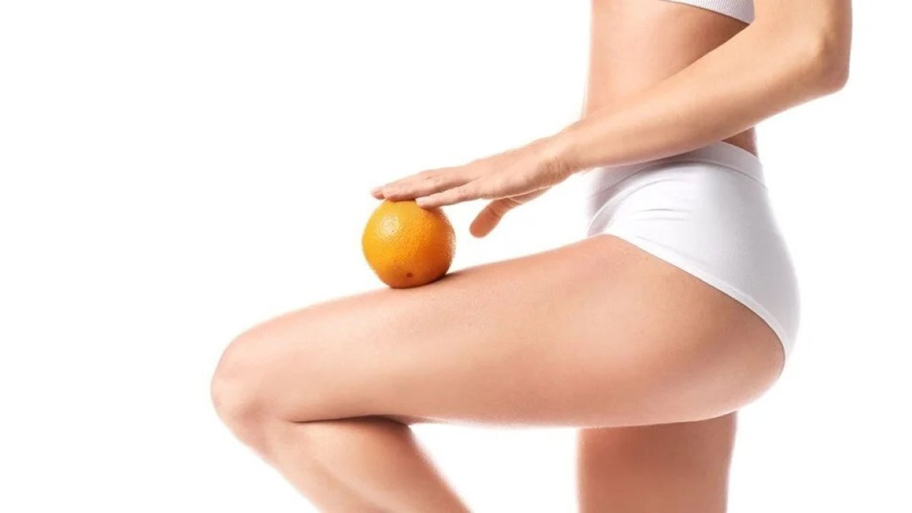 Yaz yaklaşıyor. Selüliti olanlar dikkat. Bu yiyeceklerden uzan durun