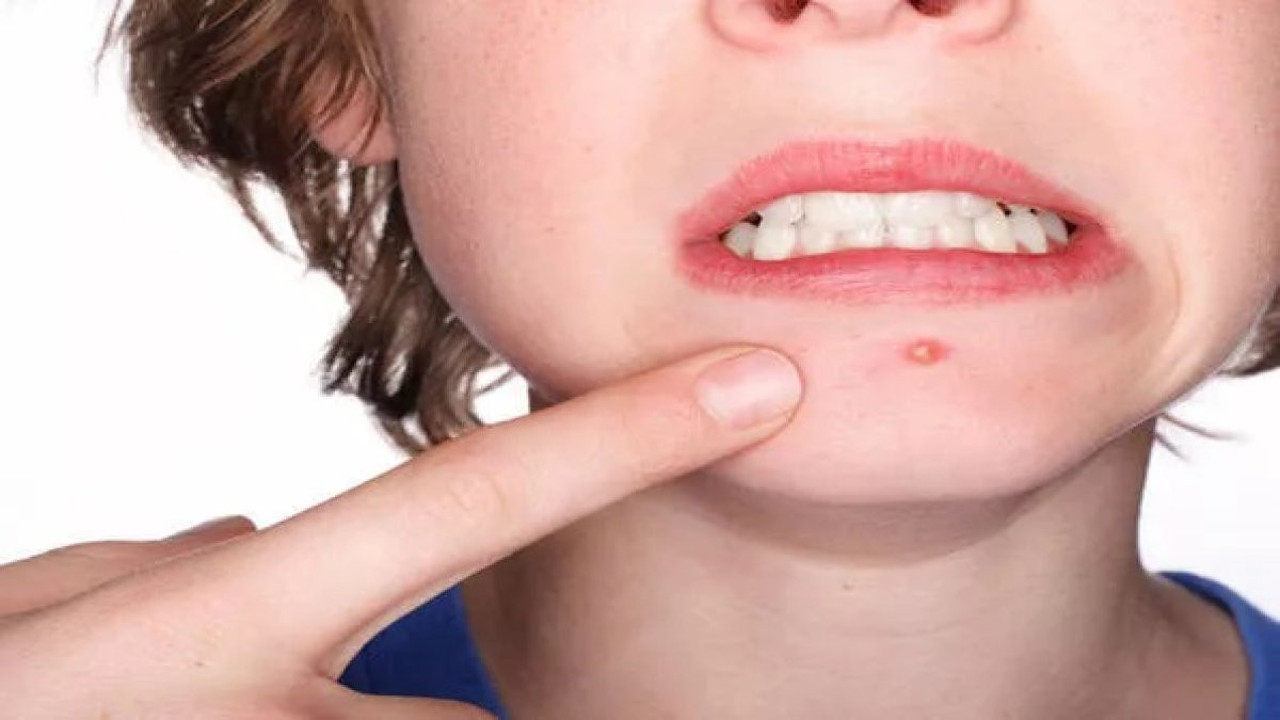 Sivilcelere iyi geliyor. Dikkat çeken ot