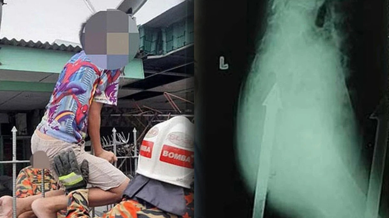 12 Yaşındaki çocuk bahçe demirine saplandı. Hastaneye korkuluklar içindeyken gönderildi