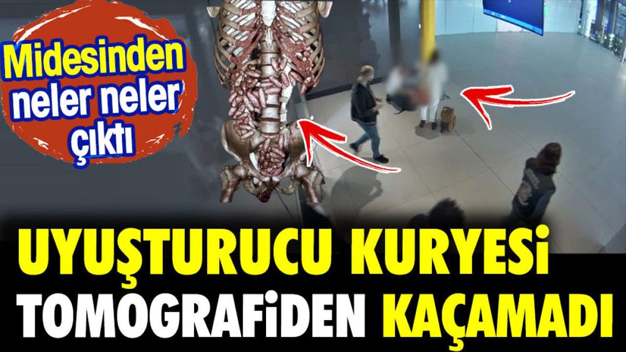 Uyuşturucu kuryesi tomografiden kaçamadı. Midesinde neler neler çıktı
